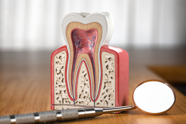 Root Canal Treatment in Portland
