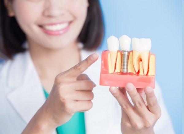 Restore Your Smile With Confidence With Our Implant Dentistry